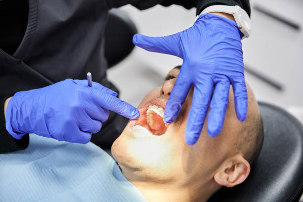 Best Emergency Treatment for Dental Infections or Abscesses in Belton, SC